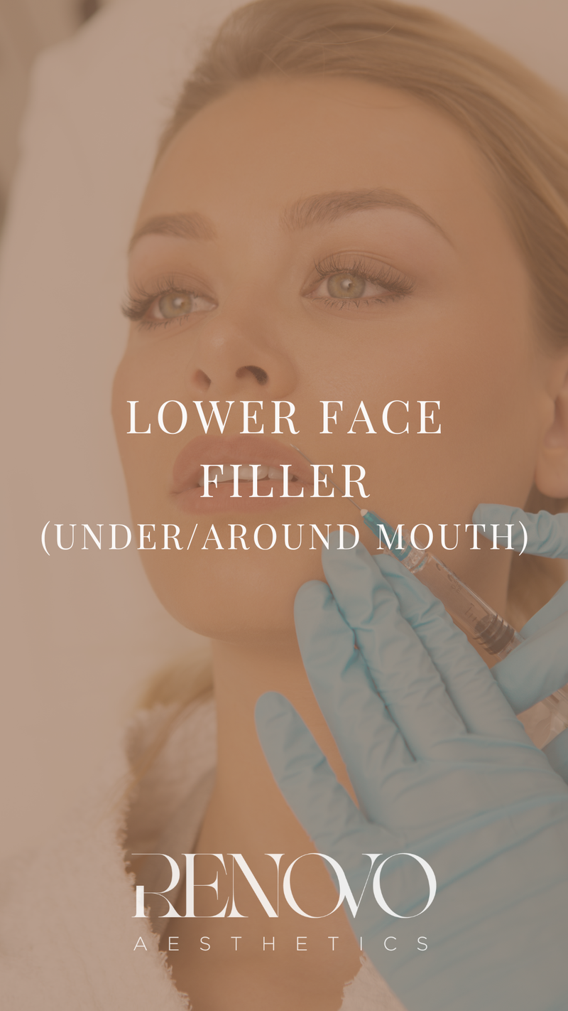 Lower Face Filler (under / around mouth)