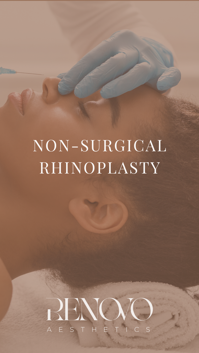 Non-Surgical Rhinoplasty