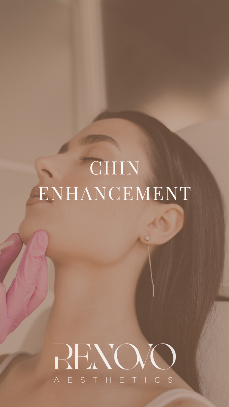 Chin Enhancement