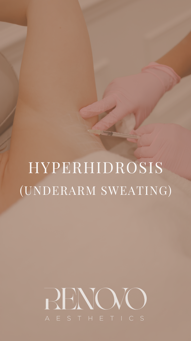 Underarm Sweating (Hyperhidrosis)