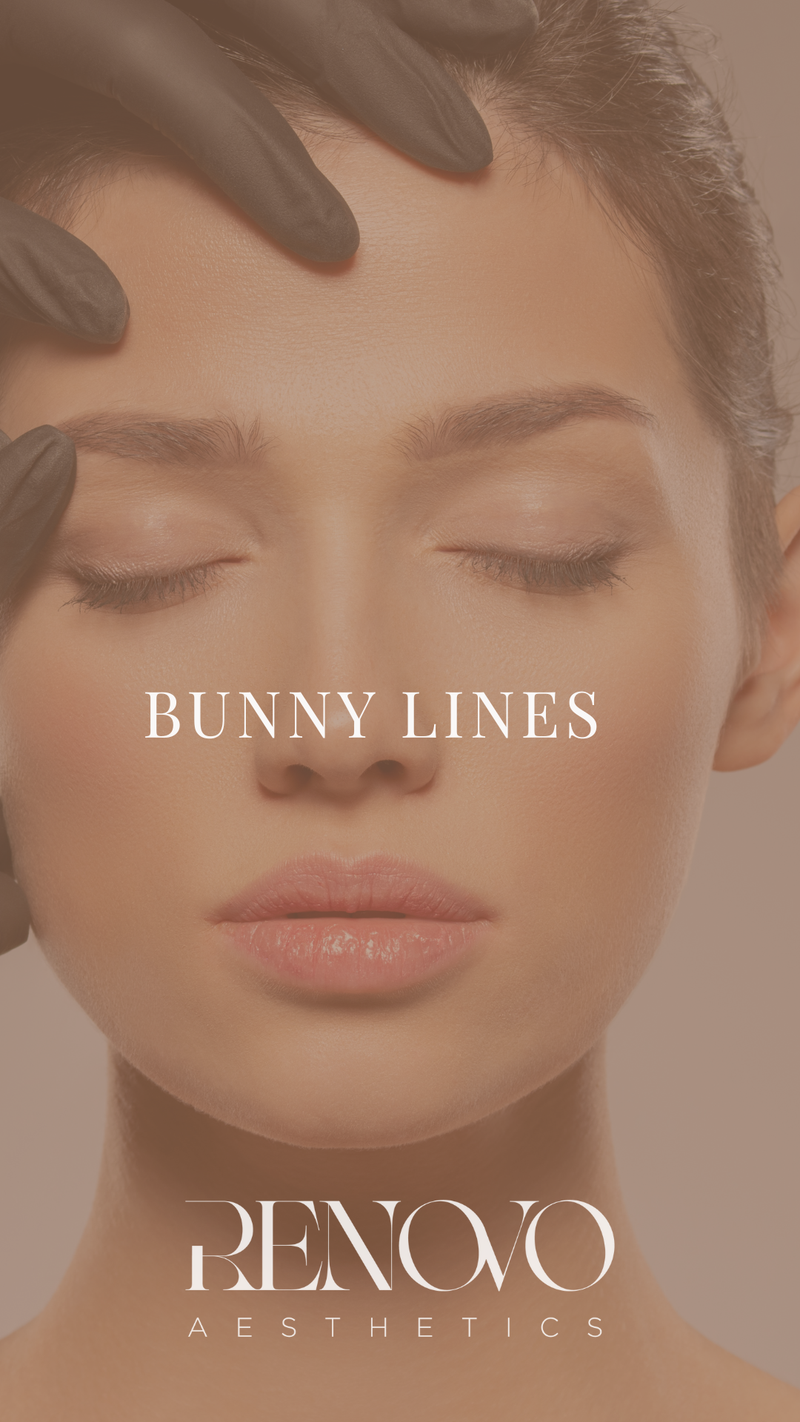 Bunny Lines