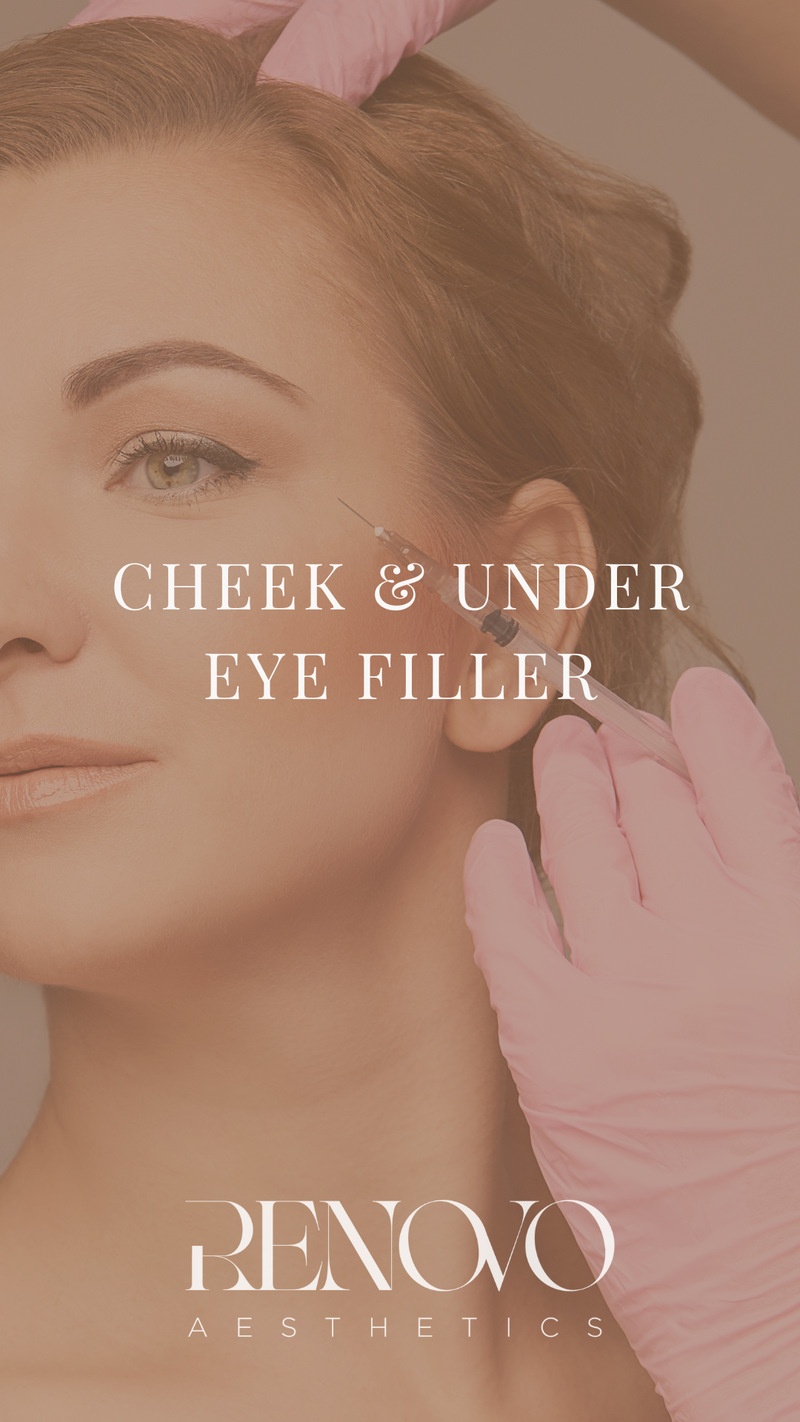 Cheek & Under Eye Filler