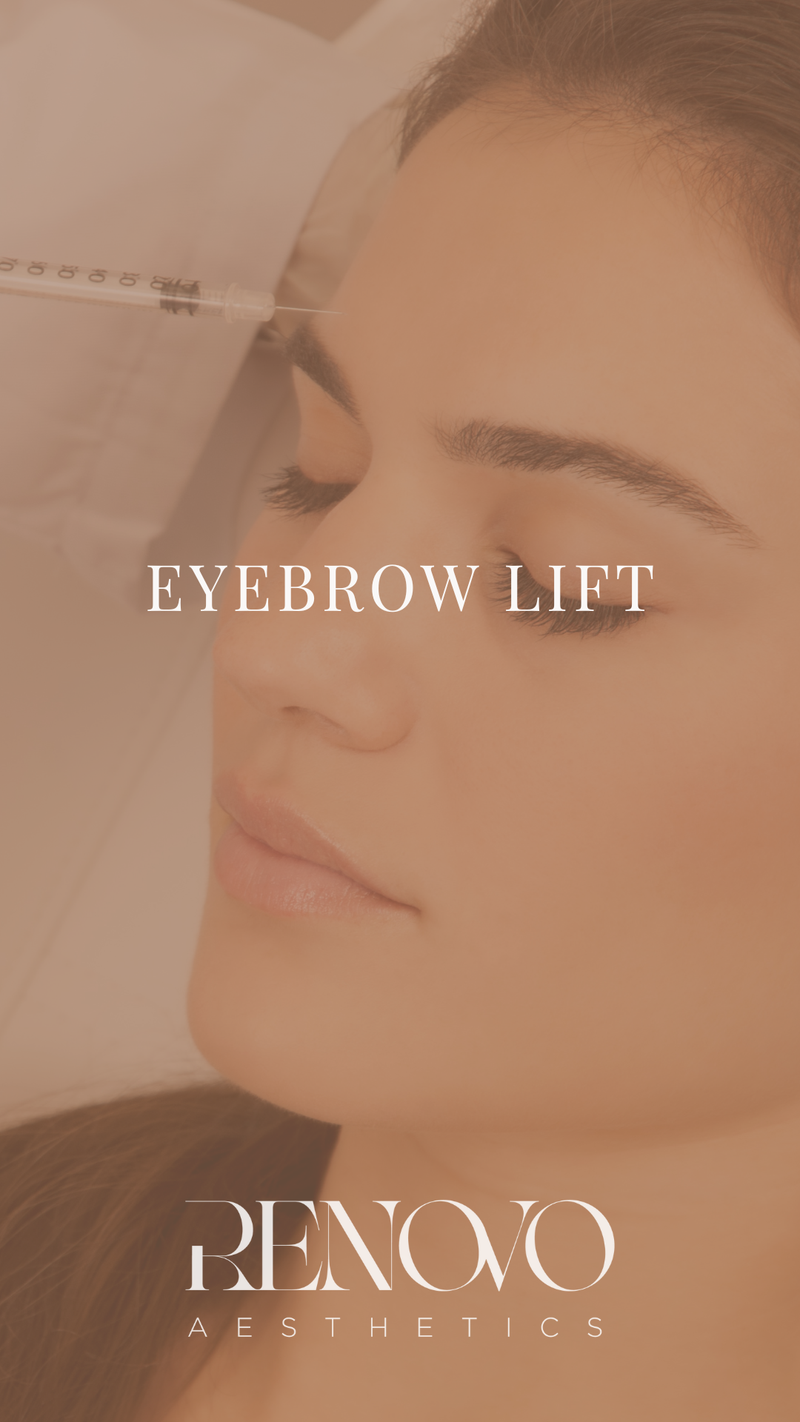 Eyebrow Lift